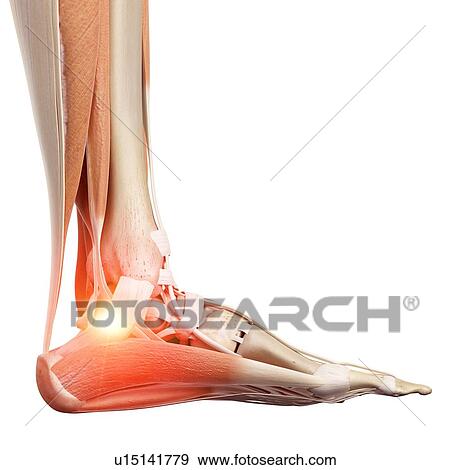 Stock Photo - Illustration of a painful ankle.. Fotosearch