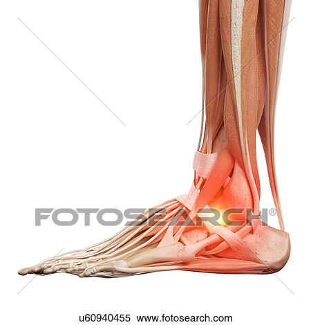 Stock Photography - Illustration of a painful ankle.. Fotosearch