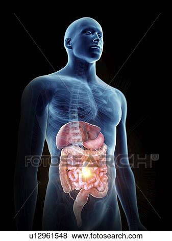 Stock Photo - Illustration of a painful digestive system.. Fotosearch