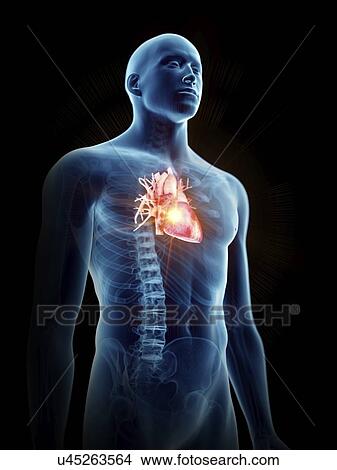 Picture - Illustration of a painful heart.. Fotosearch