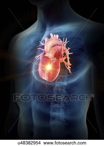 Picture - Illustration of a painful heart.. Fotosearch