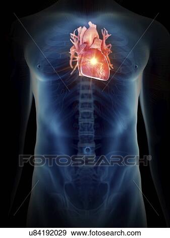 Stock Photo - Illustration of a painful heart.. Fotosearch