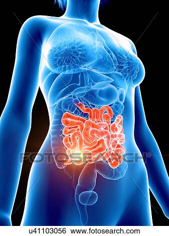 Illustration of a painful intestine. View Large Photo Image Stock Photograph - Illustration of a painful intestine.. Fotosearch