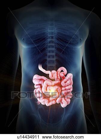 Illustration of a painful small intestine. View Large Photo Image Stock Image - Illustration of a painful small intestine.. Fotosearch
