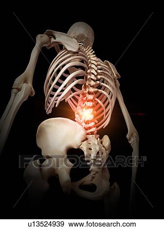 Stock Photo - Illustration of a painful spine.. Fotosearch