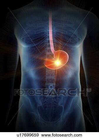 Stock Photo - Illustration of a painful stomach.. Fotosearch