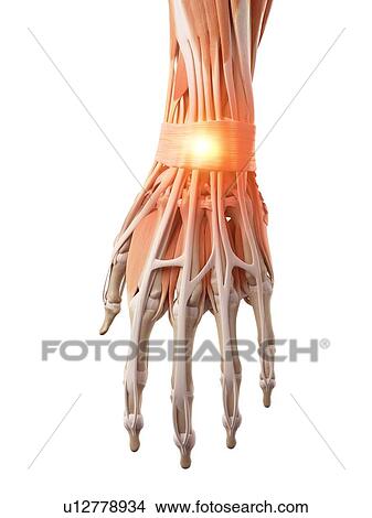 Picture - Illustration of a painful wrist.. Fotosearch