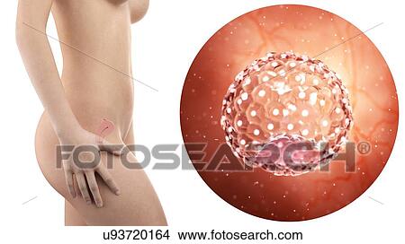 Picture - Illustration of a pregnant woman with visible uterus and blastocyst.. Fotosearch