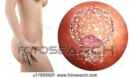 Stock Image - Illustration of a pregnant woman with visible uterus and implanted blastocyst,.. Fotosearch