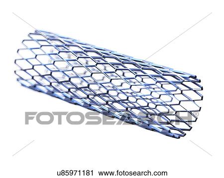 Illustration of a stent. View Large Photo Image Stock Image - Illustration of a stent.. Fotosearch