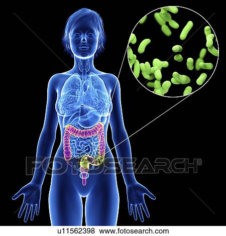 Illustration of a woman's colon infection. View Large Photo Image Stock Photo - Illustration of a woman's colon infection.. Fotosearch
