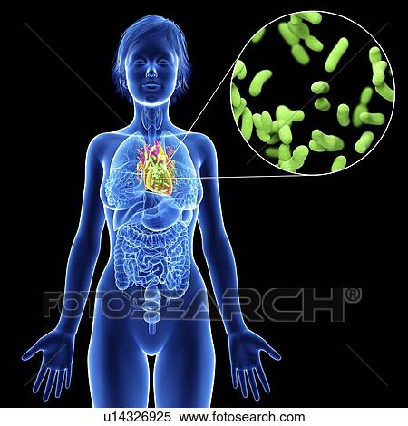 Stock Photography - Illustration of a woman's heart infection.. Fotosearch