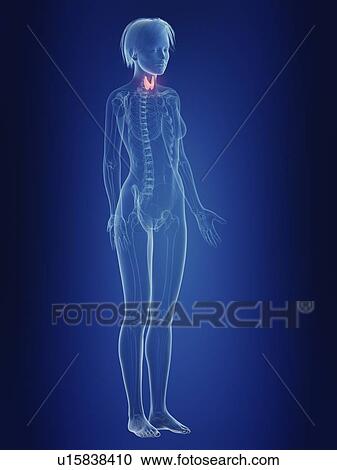 Stock Image - Illustration of a woman's inflamed thyroid gland.. Fotosearch