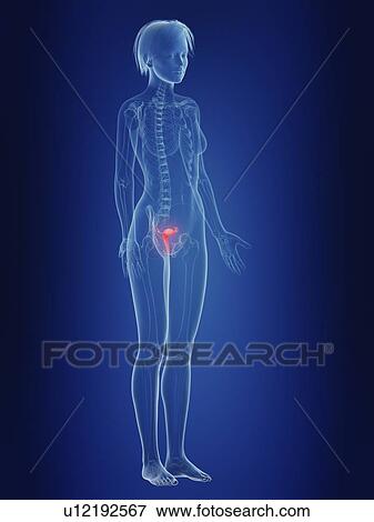 Stock Photo - Illustration of a woman's inflamed uterus.. Fotosearch