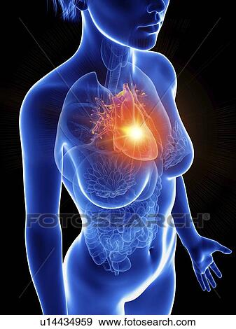 Illustration of a woman's inflamed heart. View Large Photo Image Stock Photo - Illustration of a woman's inflamed heart.. Fotosearch