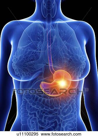 Stock Photography - Illustration of a woman's inflamed stomach.. Fotosearch
