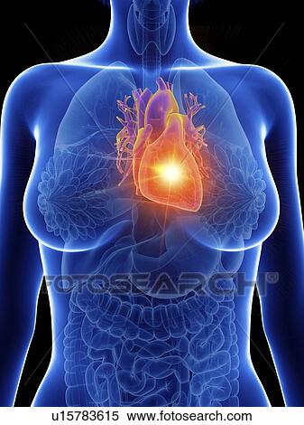 Stock Photography - Illustration of a woman's inflamed heart.. Fotosearch