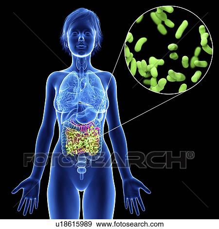 Illustration of a woman's intestine infection. View Large Photo Image Stock Photo - Illustration of a woman's intestine infection.. Fotosearch