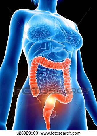 Stock Image - Illustration of a woman's painful colon.. Fotosearch