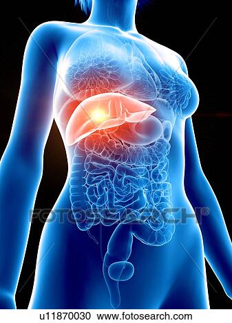 Illustration of a woman's painful liver. View Large Photo Image Stock Image - Illustration of a woman's painful liver.. Fotosearch