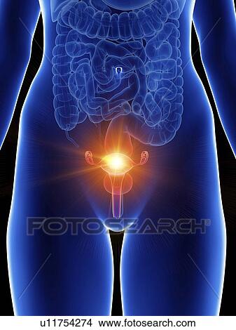 Picture - Illustration of a woman's painful uterus.. Fotosearch