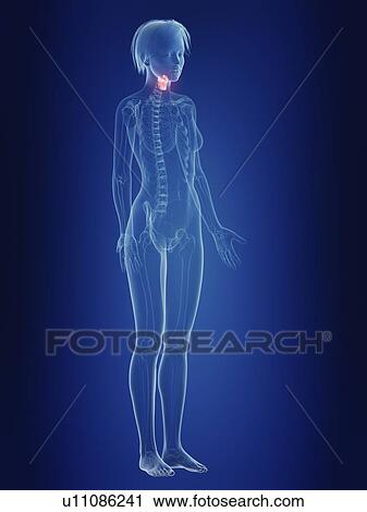 Stock Image - Illustration of a woman's painful larynx.. Fotosearch