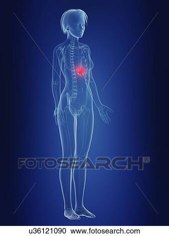 Stock Image - Illustration of a woman's painful spleen.. Fotosearch
