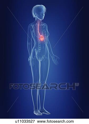 Stock Photo - Illustration of a woman's painful stomach.. Fotosearch
