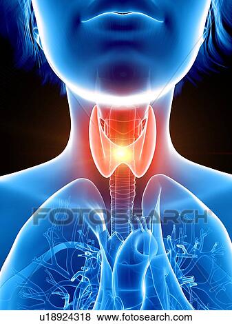 Illustration of a woman's painful throat. View Large Photo Image Stock Photo - Illustration of a woman's painful throat.. Fotosearch