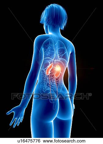 Stock Photograph - Illustration of a woman's painful kidney.. Fotosearch