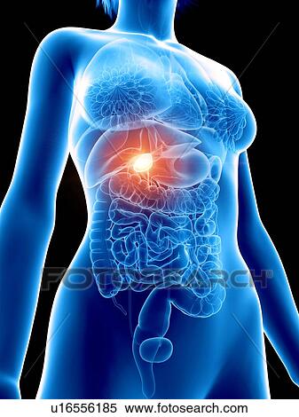 Stock Photography - Illustration of a woman's painful gallbladder.. Fotosearch