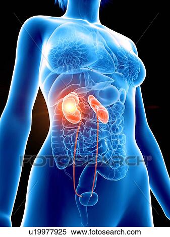 Stock Photography - Illustration of a woman's painful kidney.. Fotosearch