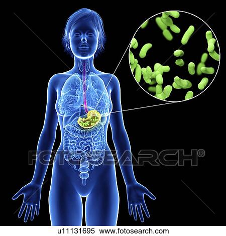 Stock Photography - Illustration of a woman's stomach infection.. Fotosearch