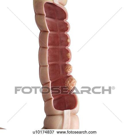 Illustration of an anterior cut of the human colon. View Large Photo Image Stock Photo - Illustration of an anterior cut of the human colon.. Fotosearch