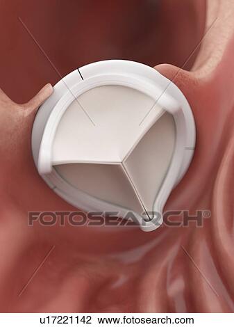 Stock Image - Illustration of an artificial heart valve.. Fotosearch