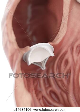 Stock Photograph - Illustration of an artificial heart valve.. Fotosearch