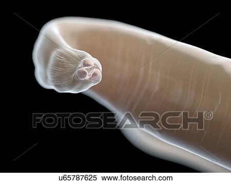 Stock Photography - Illustration of an ascariasis worm.. Fotosearch