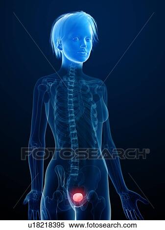 Illustration of an inflamed bladder. View Large Photo Image Stock Photography - Illustration of an inflamed bladder.. Fotosearch