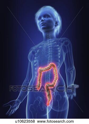 Illustration of an inflamed colon. View Large Photo Image Stock Photo - Illustration of an inflamed colon.. Fotosearch