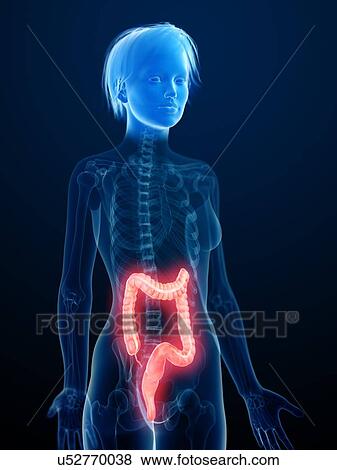 Stock Photo - Illustration of an inflamed colon.. Fotosearch