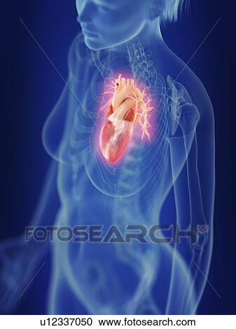 Illustration of an inflamed heart. View Large Photo Image Stock Image - Illustration of an inflamed heart.. Fotosearch