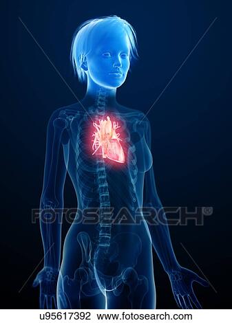 Illustration of an inflamed heart. View Large Photo Image Stock Image - Illustration of an inflamed heart.. Fotosearch