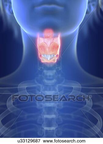 Stock Photo - Illustration of an inflamed larynx.. Fotosearch