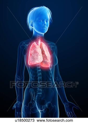 Illustration of an inflamed lung. View Large Photo Image Stock Image - Illustration of an inflamed lung.. Fotosearch