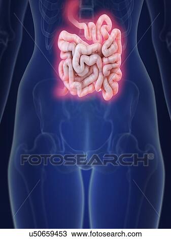 Stock Image - Illustration of an inflamed small intestine.. Fotosearch