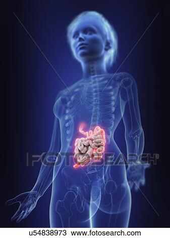 Illustration of an inflamed small intestine. View Large Photo Image Stock Image - Illustration of an inflamed small intestine.. Fotosearch