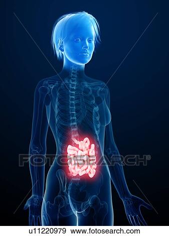 Illustration of an inflamed small intestine. View Large Photo Image Stock Photo - Illustration of an inflamed small intestine.. Fotosearch