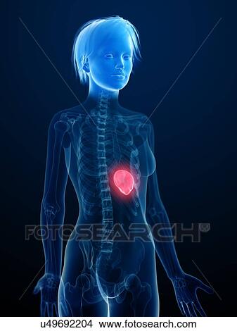 Picture - Illustration of an inflamed spleen.. Fotosearch