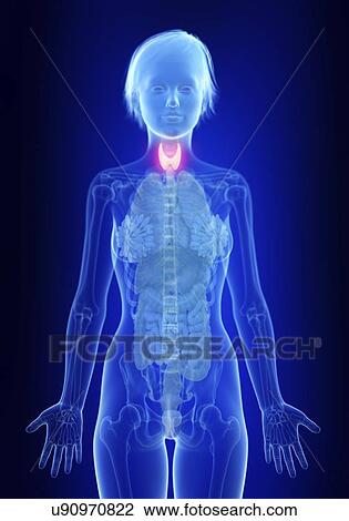 Stock Image - Illustration of an inflamed thyroid gland.. Fotosearch