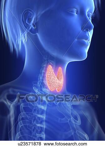 Illustration of an inflamed thyroid. View Large Photo Image Stock Photo - Illustration of an inflamed thyroid.. Fotosearch